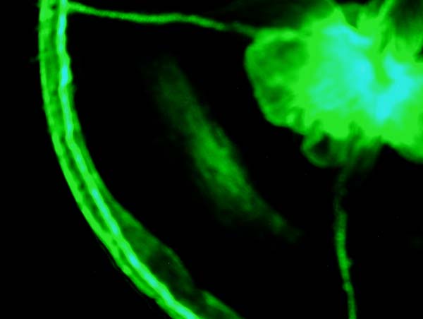 Green Fluorescent Protein