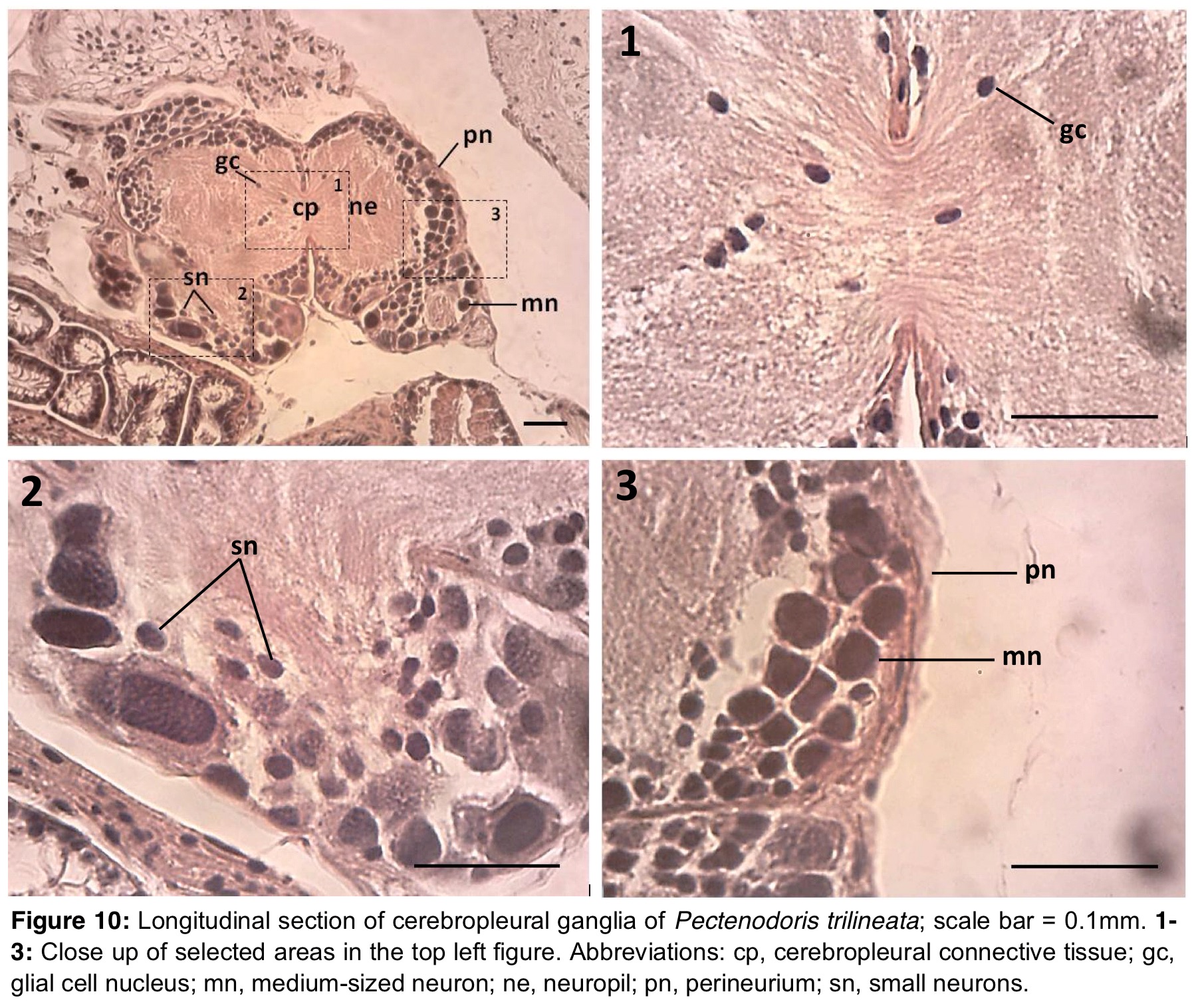 figure image